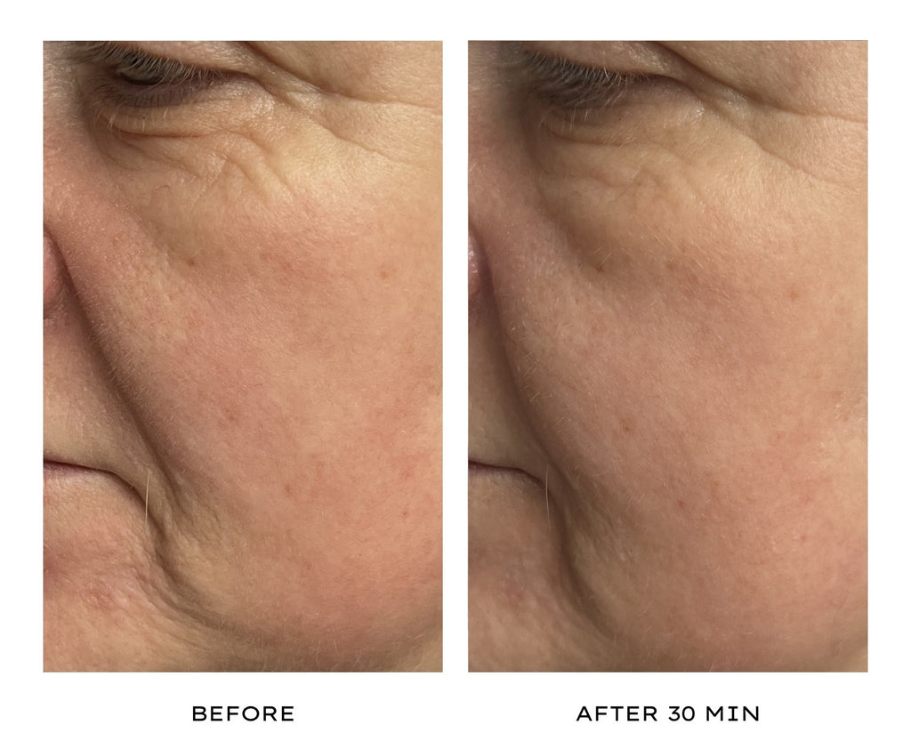 The Miracle Mask | Before and after 30 min