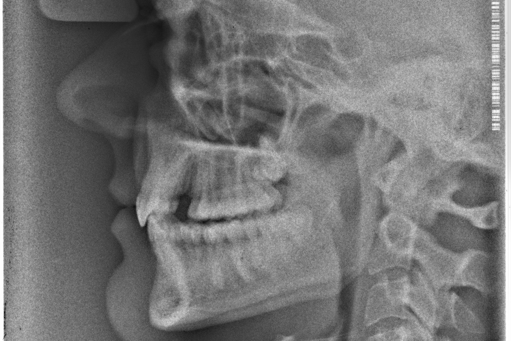 SPA AESTHETIC BRACKETS