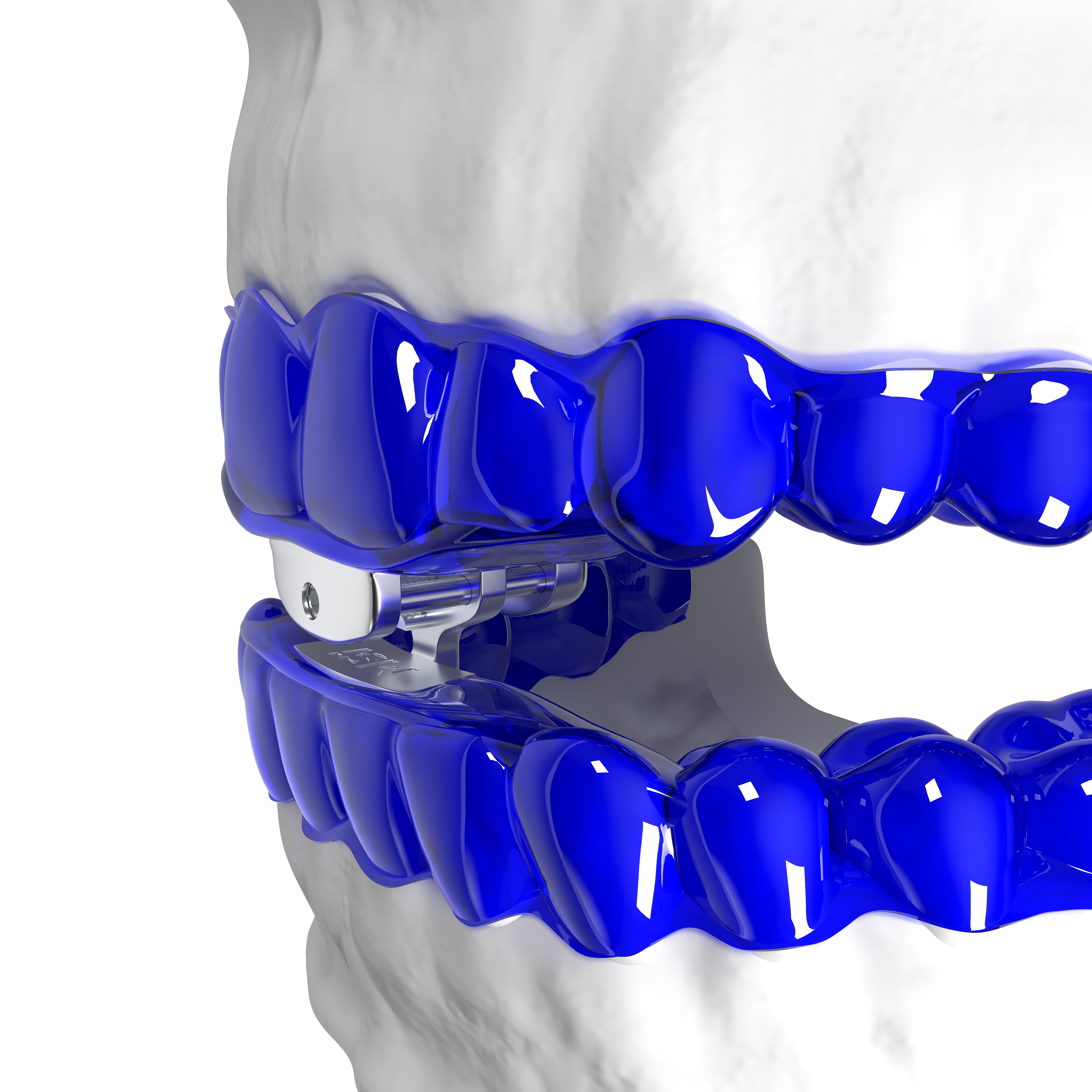 Mandibular Snoring Inhibitor