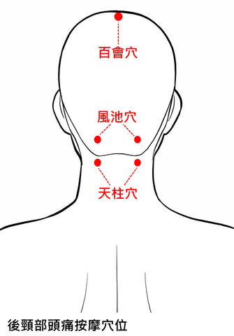 #中醫 #萬全堂 #眼型偏頭痛