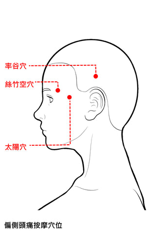 #中醫 #萬全堂 #眼型偏頭痛