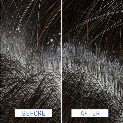 Scalp Rescue Serum Results