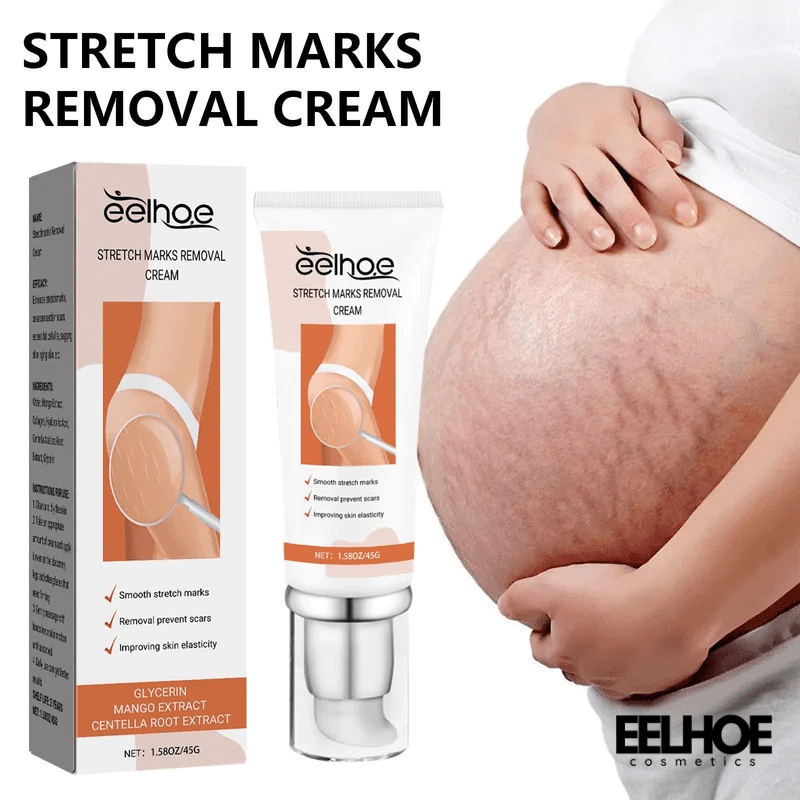 Anti Stretch Mark oil for Postpartum and Obesity