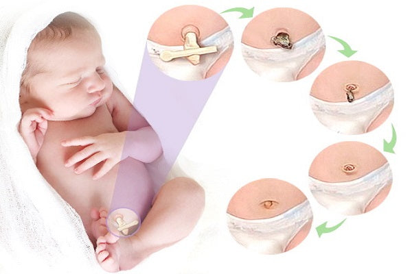 umbilical cord healing process stages natural care