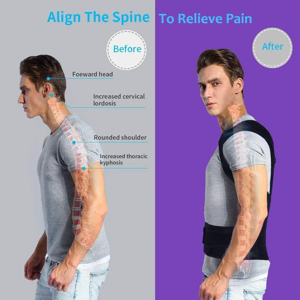 Fitsupport-Back-Brace-and-Posture-Corrector-4.webp__PID:4d6a5b17-ca81-41fa-974e-c9e8cff38efe