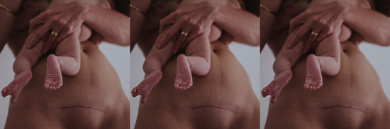 Womans C-Section Scar, holding her baby, c-section recovery trousers