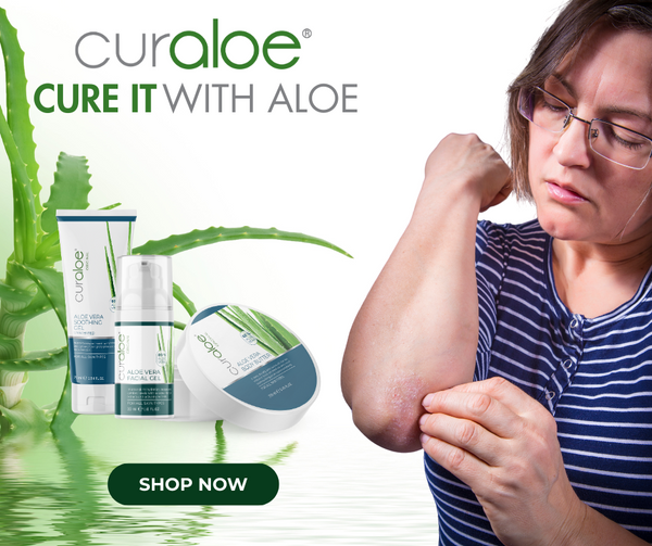 A lady with psoriasis skin problem and the Curaloe Soothing Gel and Body Cutter made from aloe vera  to help solve the psoriasis problem