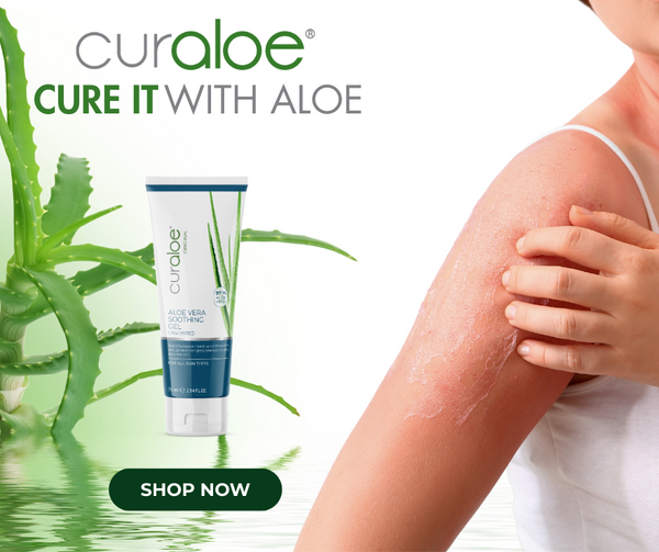 A lady with sunburn problem and the Curaloe Soothing Gel made from aloe vera  to help solve the skin burn problem