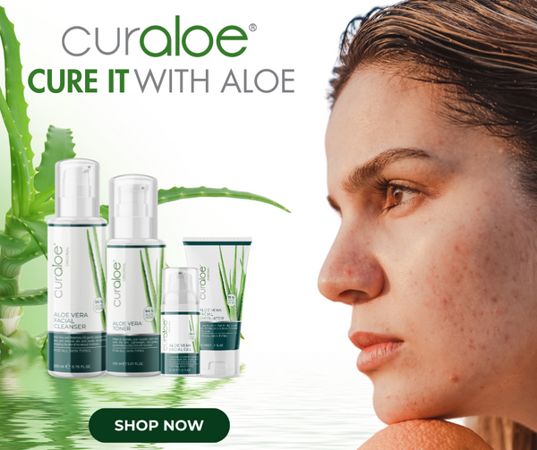 A lady with acne skin problem and the Curaloe Facial Cleanser, Toner and Facial Gel made from aloe vera to help solve the Acne problem