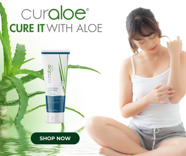 A lady with eczema skin problem and the Curaloe Soothing Gel made from aloe vera  to help solve the eczema problem