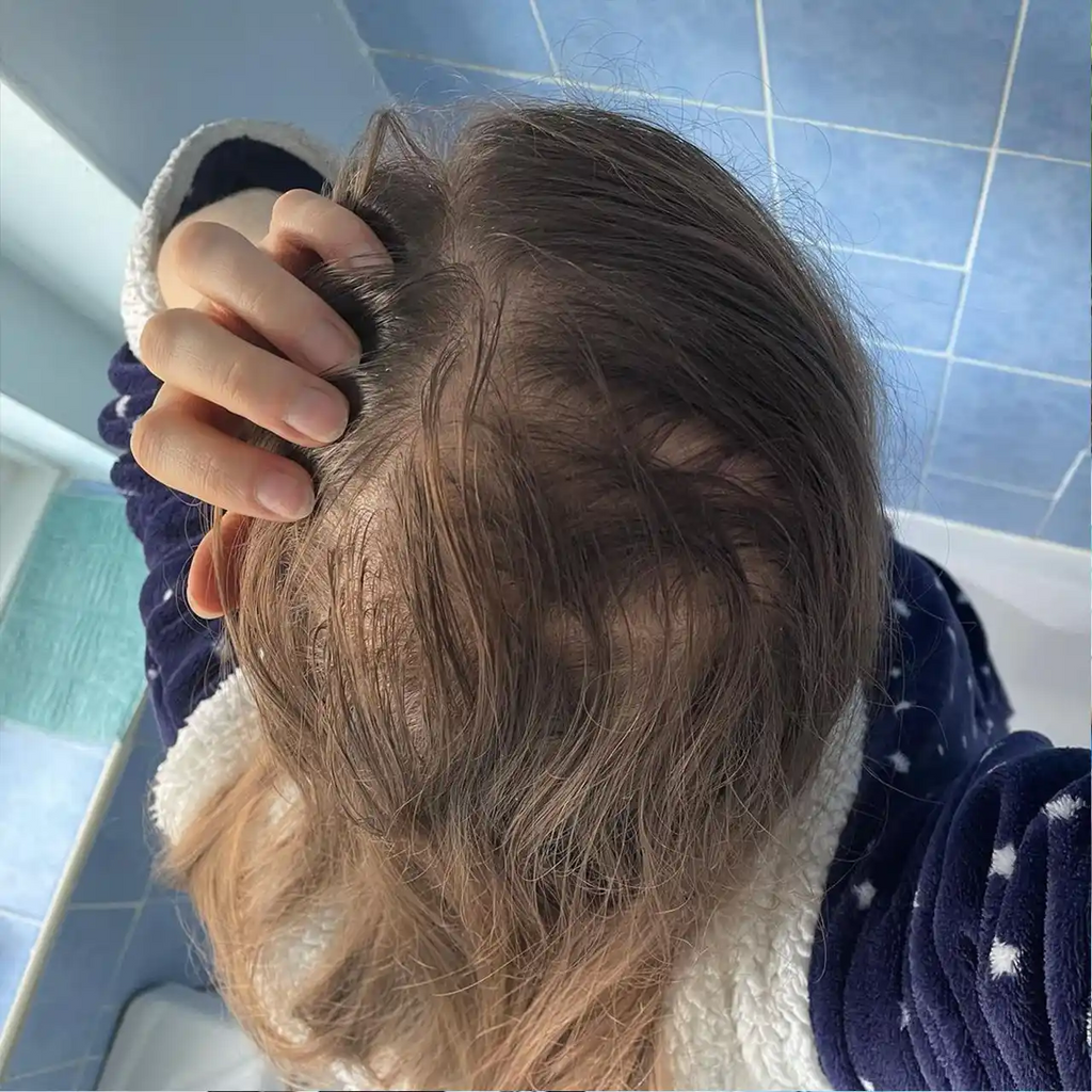 A woman is showing off her thin hair