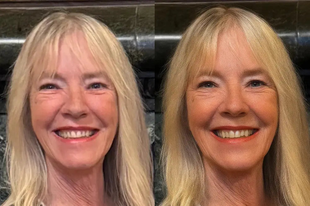 enhanced photo by ukpartymasks