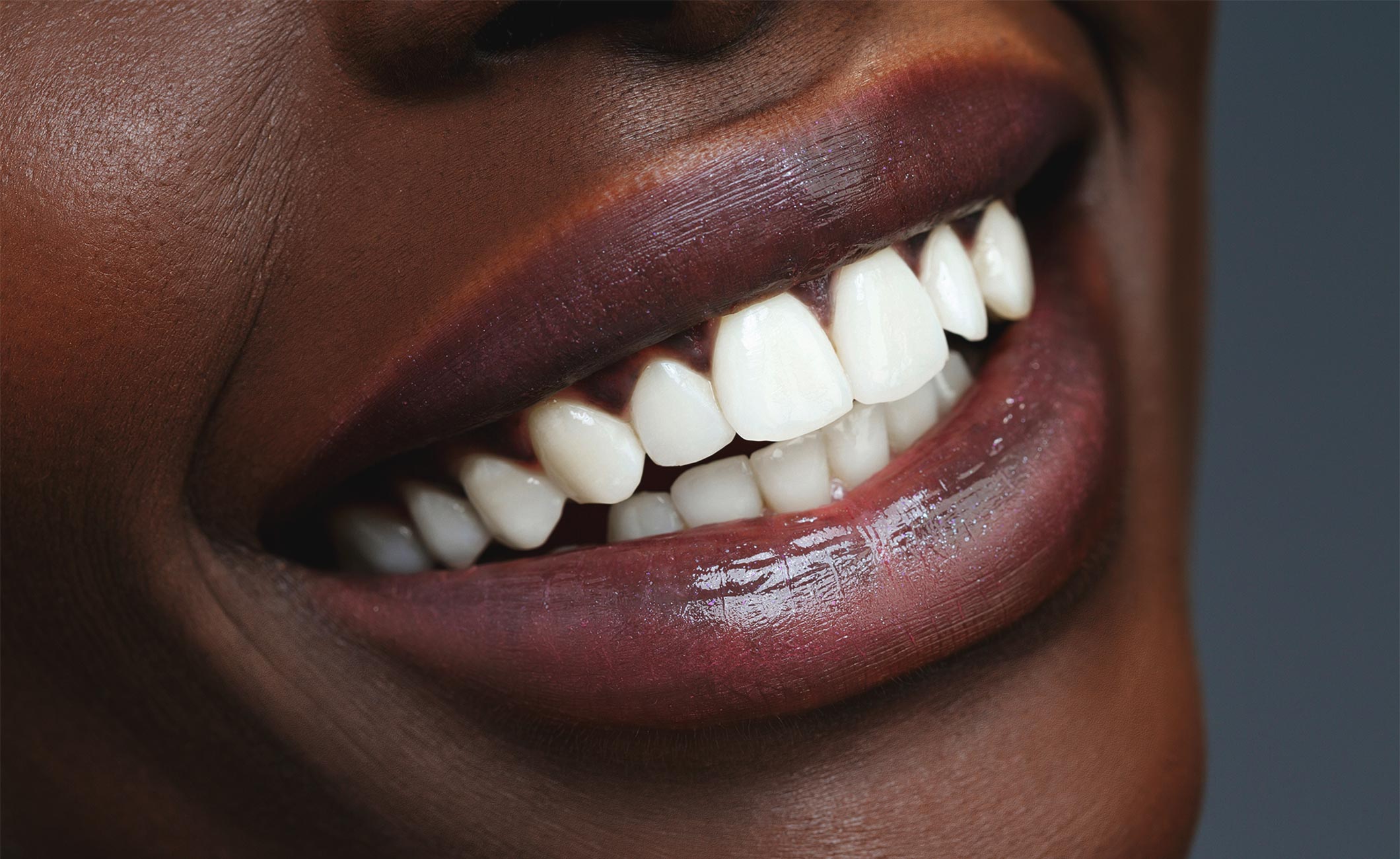 close up of a woman's white teeth 