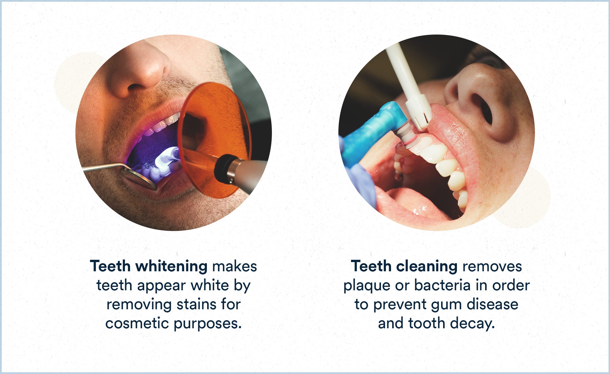 teeth whitening makes your teeth appear white and teeth cleaning removes plaque