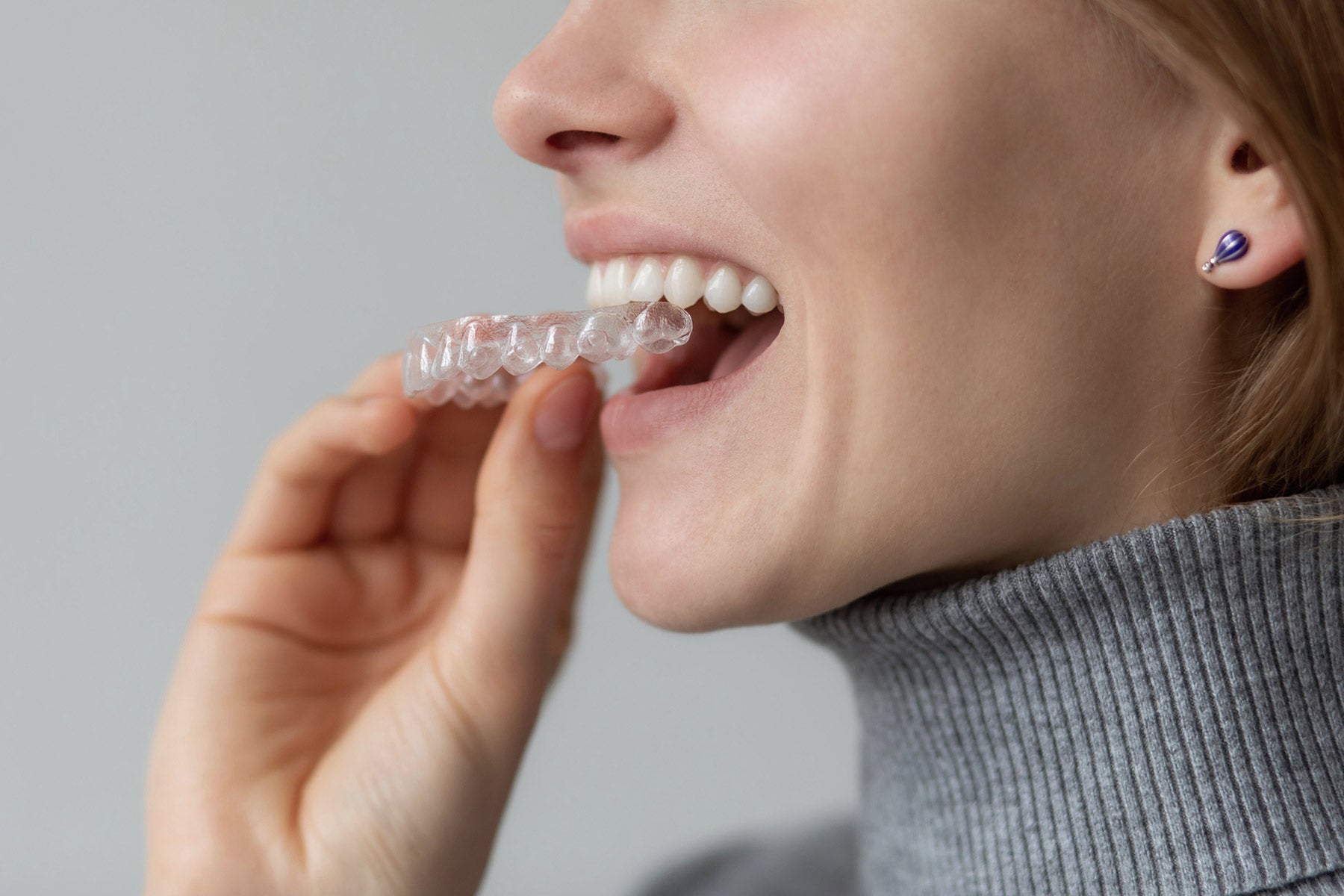woman using teeth whitening trays