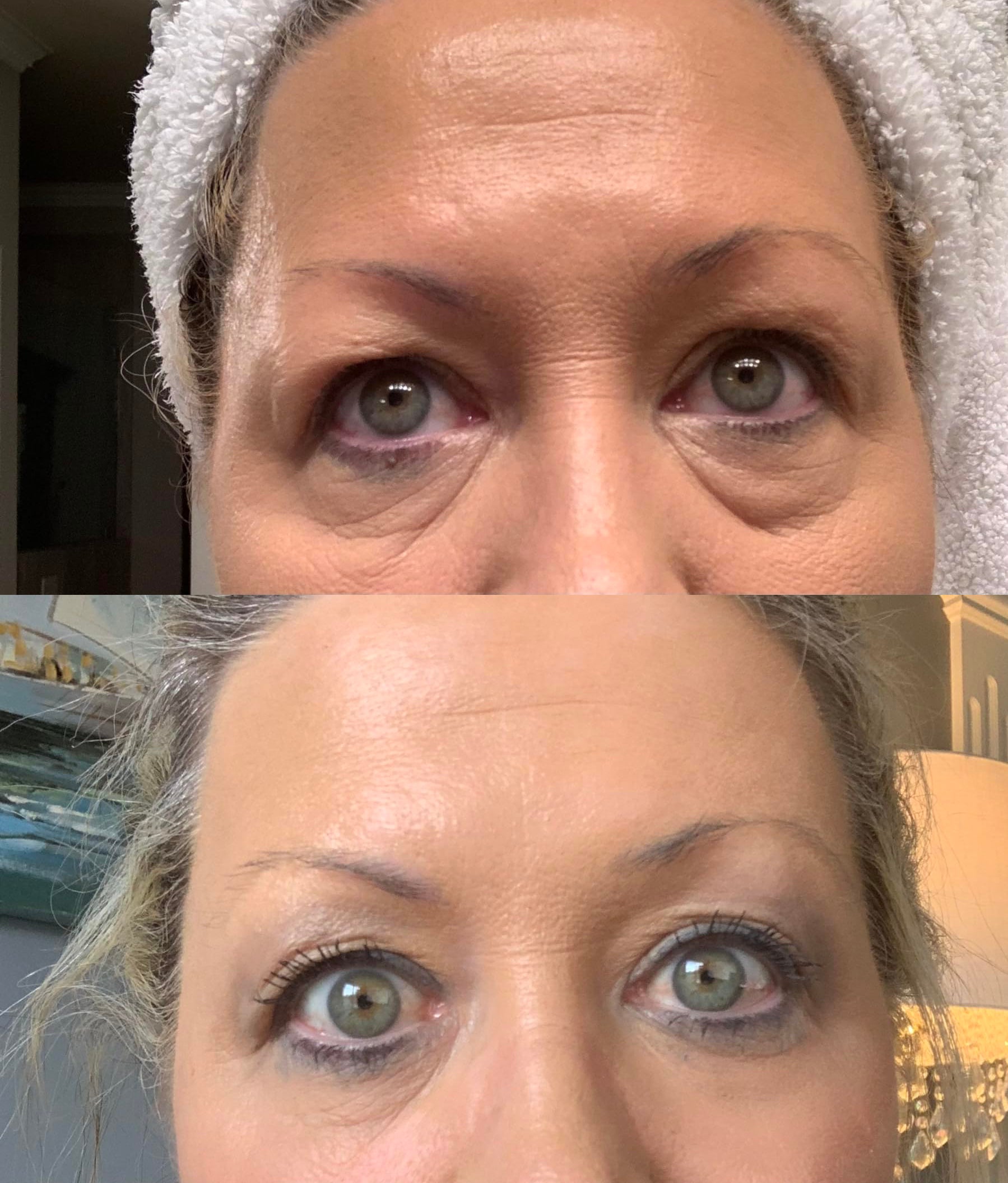 Instant store eye lift