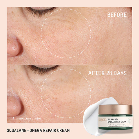 Before and After image of positive results in plumping fine lines with Omega Repair Cream