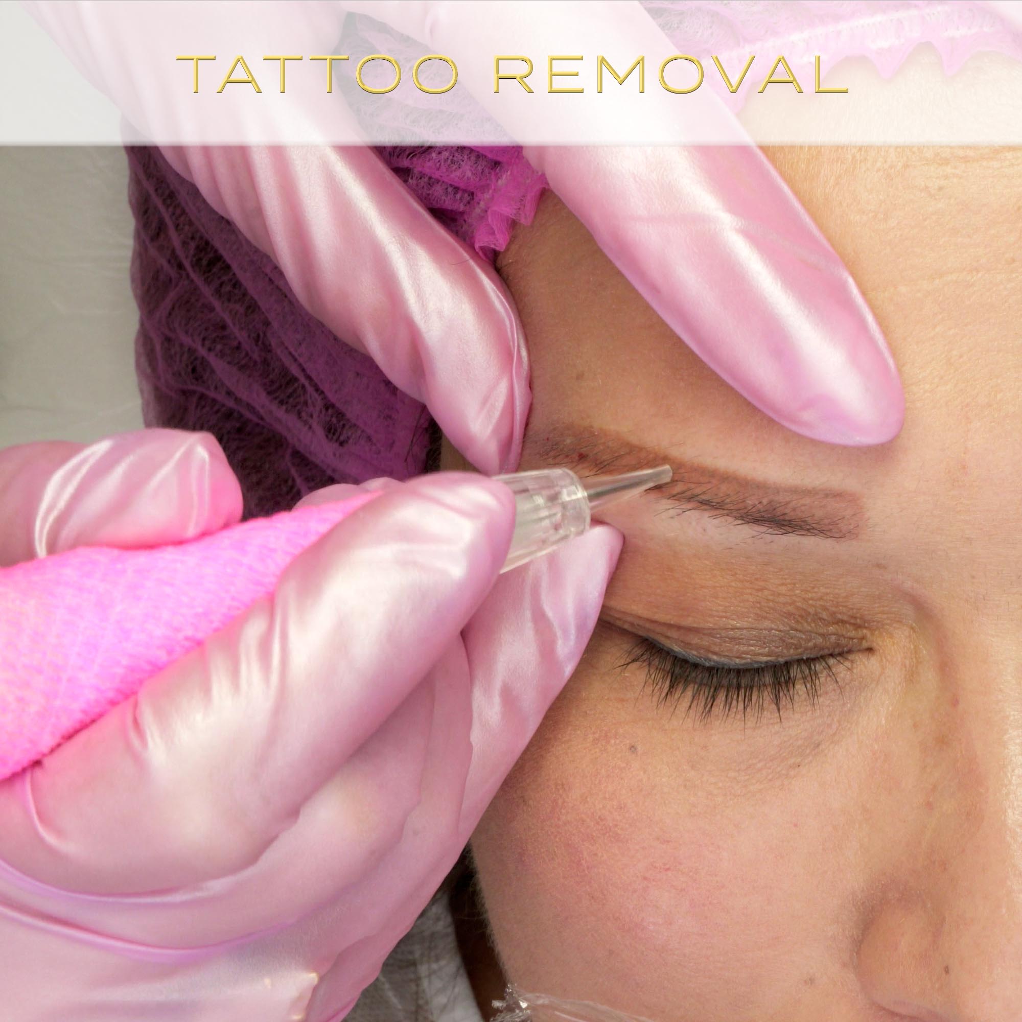 Laser Tattoo Removal Training Course  Laser Training Center of Miami  Florida