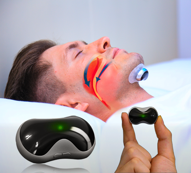 Product Image for Avelena | Silentsleep Anti-Schnarch Gerät, SnoozeFix Anti-Schnarch Gerät + 60 Elektrodenpflaster