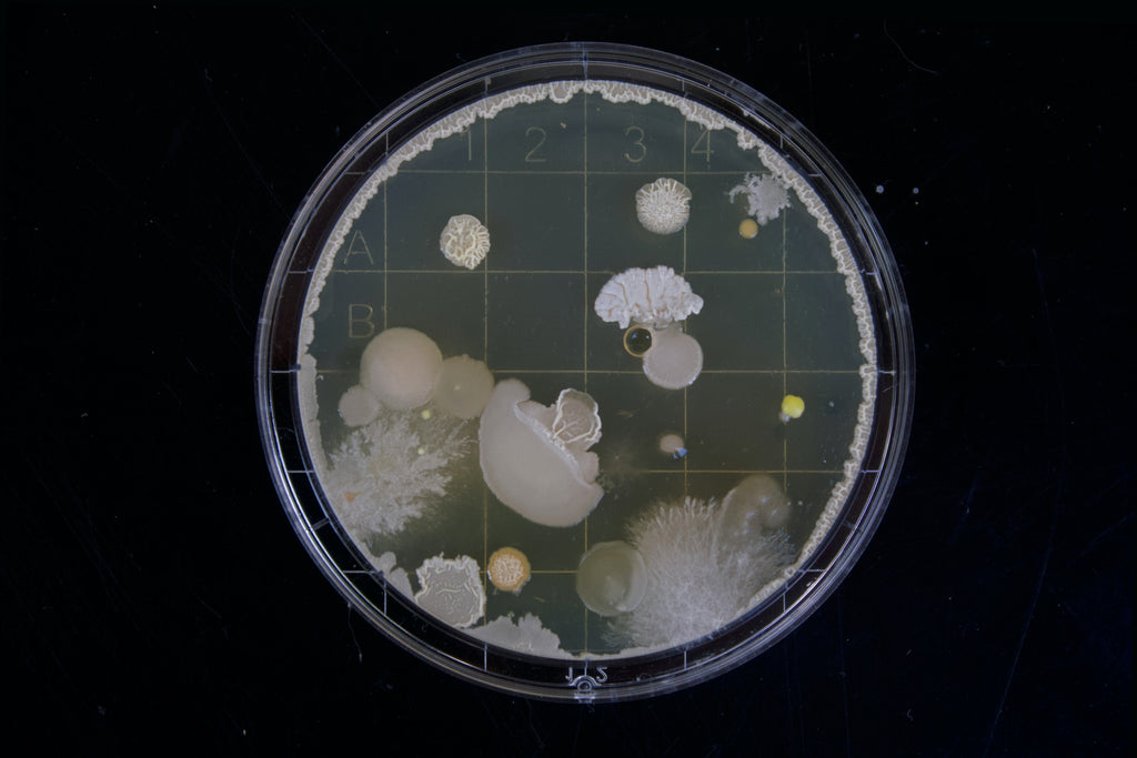 Bacteria contamination in mushroom cultivation