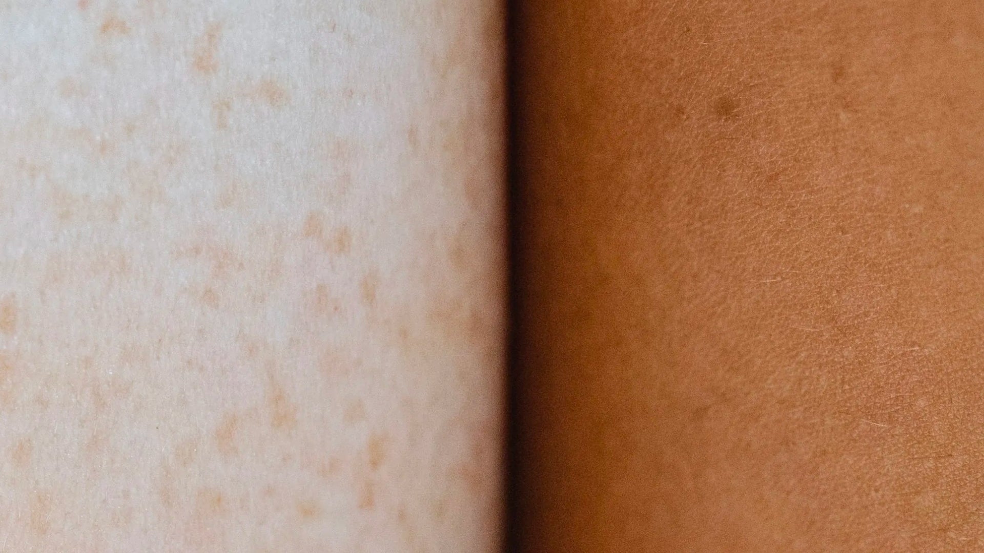 preguntas frecuentes sobre el cuidado de la piel