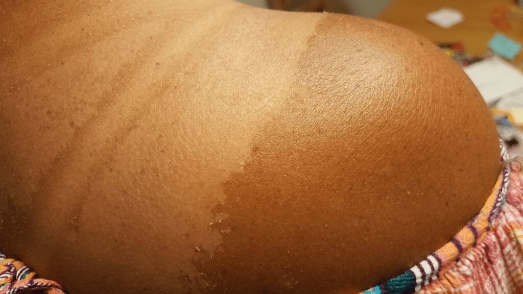 Gommage de la peau pour avoir un beau bronzage et une belle peau cet été