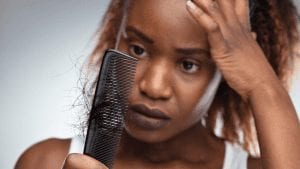 Is baldness inevitable? Madam President gives you some answers