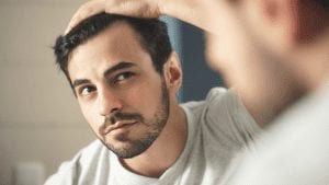 Is baldness inevitable? Madam President gives you some answers