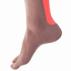 Achilles Tendonitis