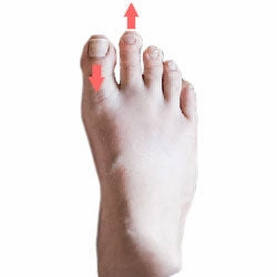 Morton's Toe