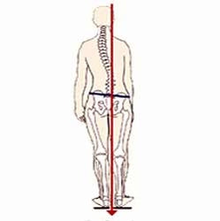 Limb Length Discrepancy