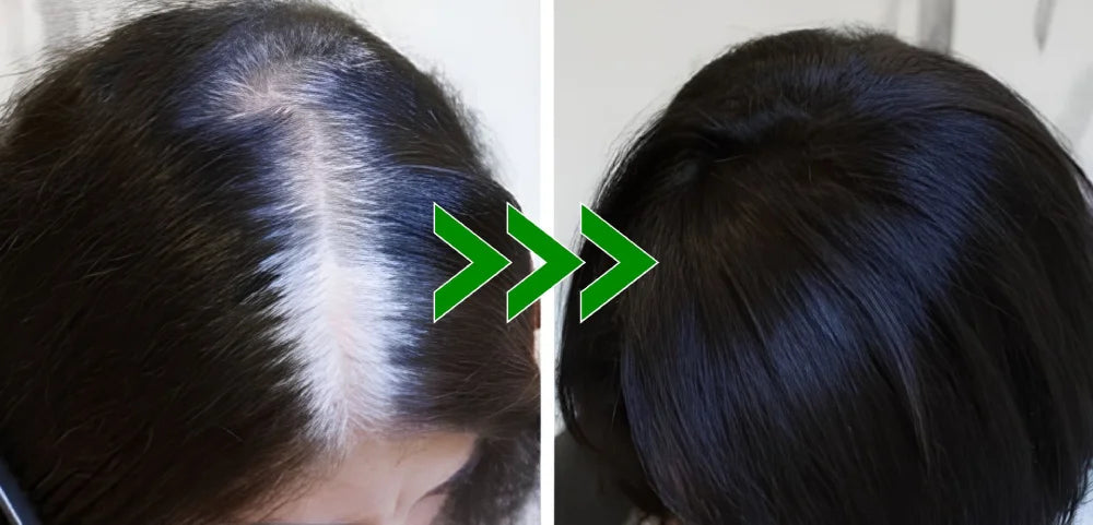 Shampoo Brimless Botânico Natural 3 em 1