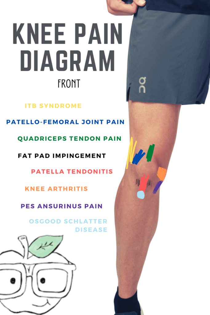 Knee Diagnosis Chart