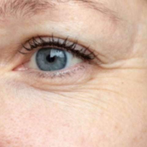 Image: Before and after of using beautifye on crow's feet (wrinkles in the corner of eye)