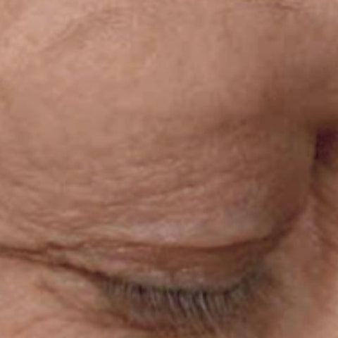 Image: Showing the difference before and after using beautifeye on eyelids