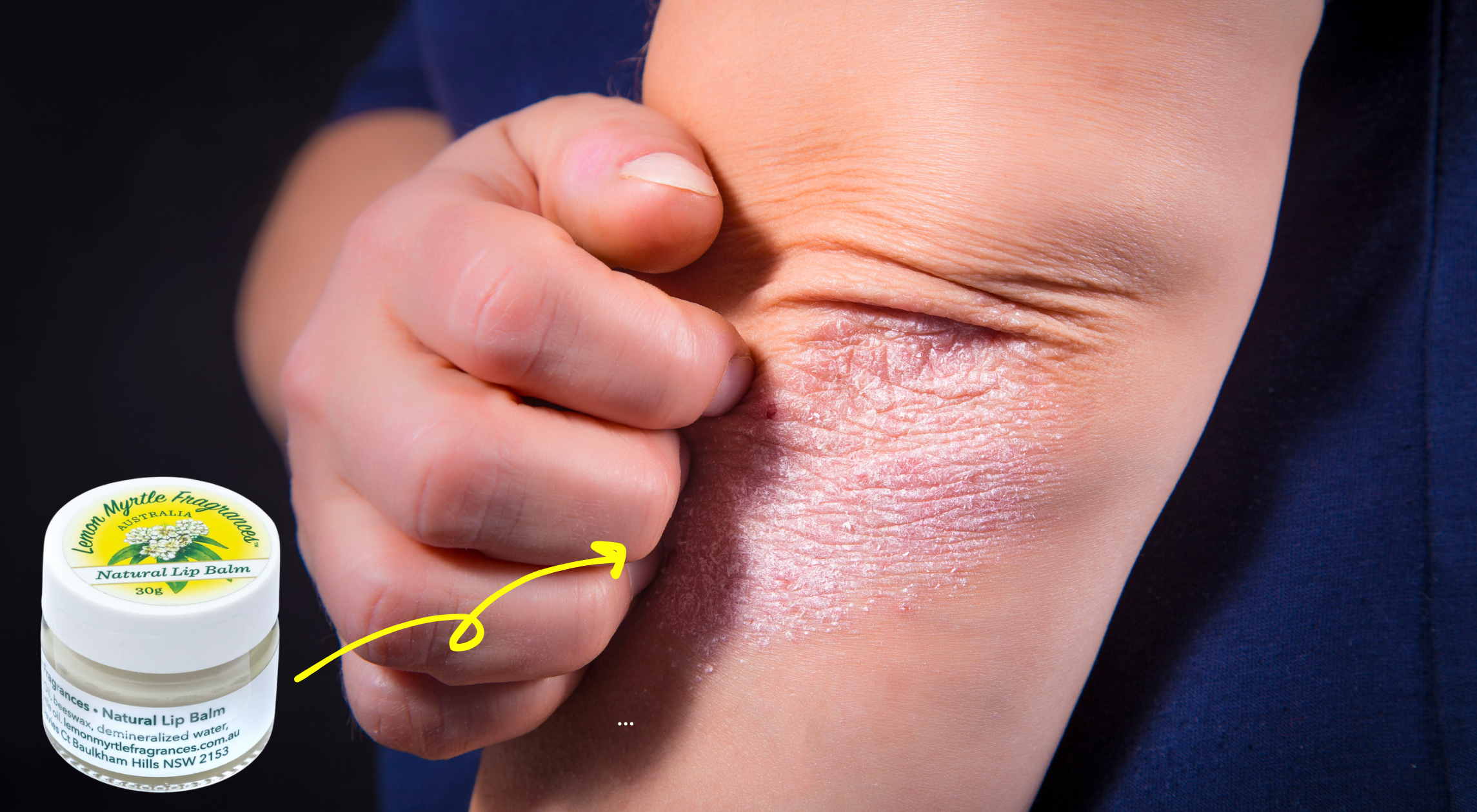 dry elbows from winter being hydrated by lemon myrtle fragrance lip balm