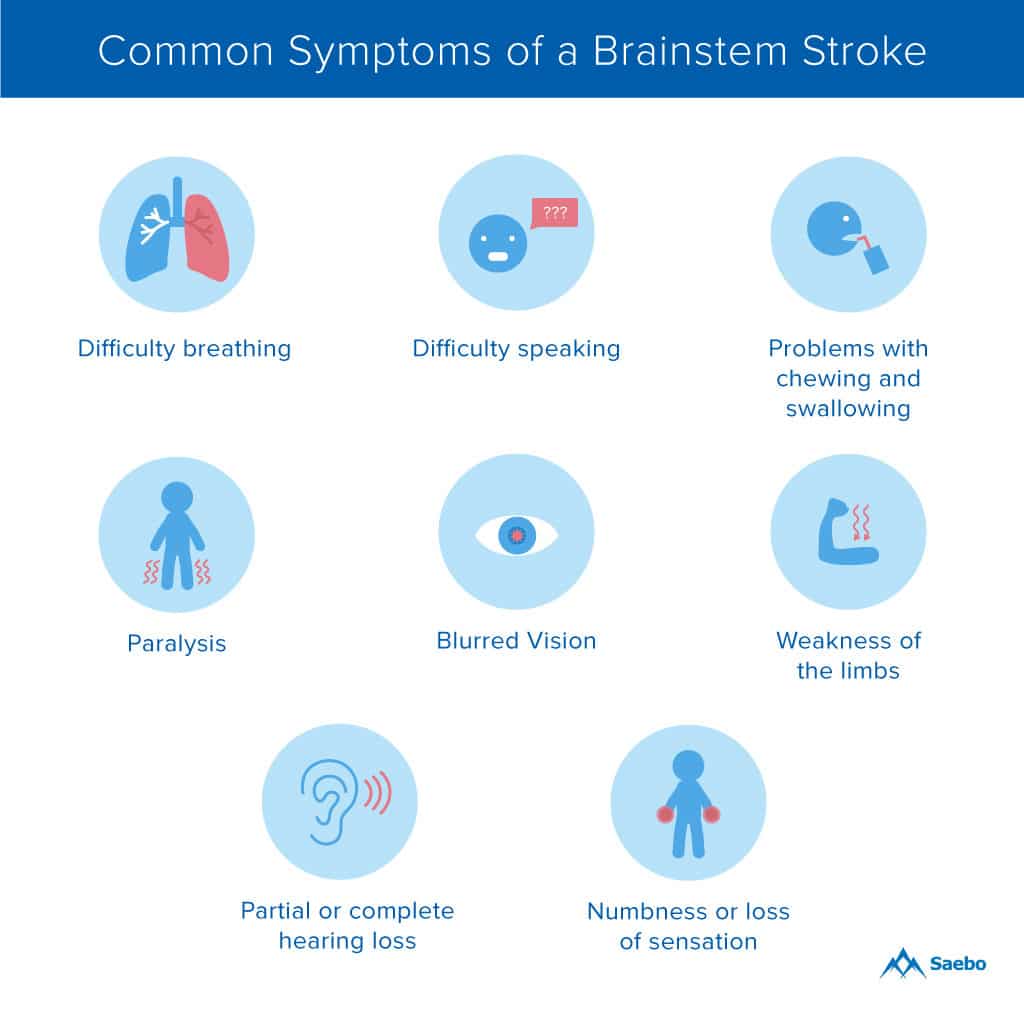 Common-symptoms-of-a-brainstem-stroke