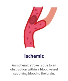ischemic