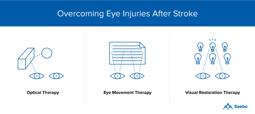 Eye Exercises for Overcoming Eye Injuries After a Stroke