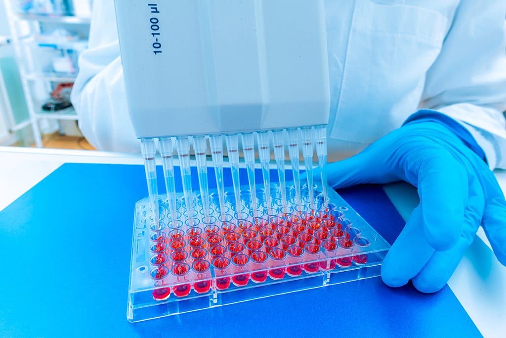 woman assistant in laboratory with multi pipette in the clinic, the research of cancer stem cells