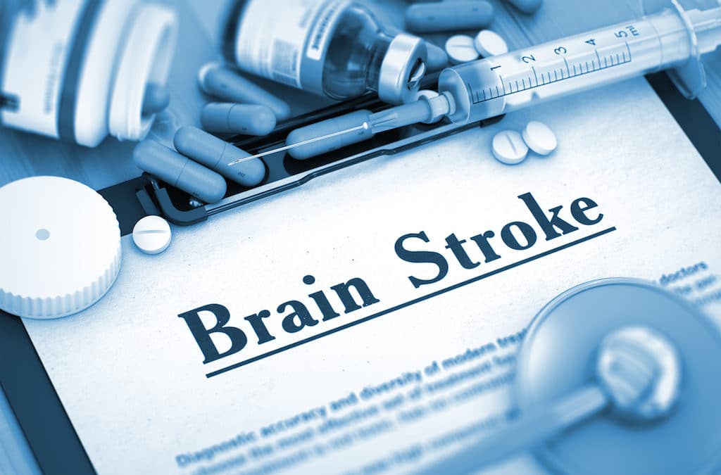Brain Stroke - Printed Diagnosis with Blurred Text. Brain Stroke Diagnosis, Medical Concept. Composition of Medicaments. 3D Toned Image.