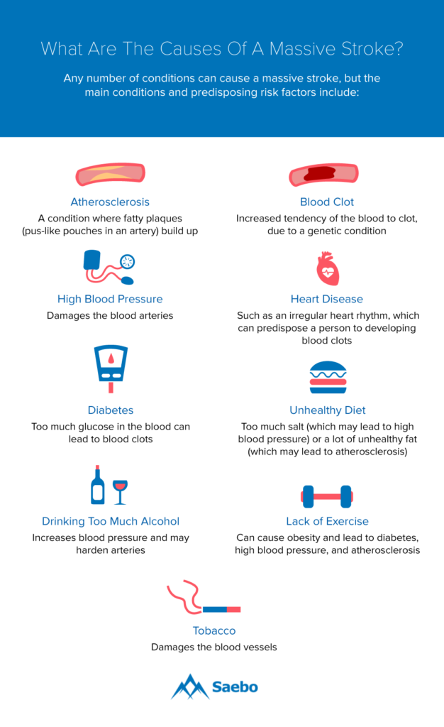 Massive Stroke What Are The Causes