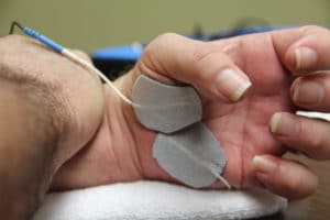 where to place electrodes on hand