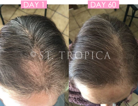 Buy Biotin Hair Loss Growth Promoter Organic Oil  Silica Infused Online in  India  Etsy