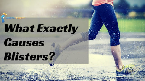 What Exactly Causes Blisters?