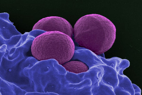 mrsa