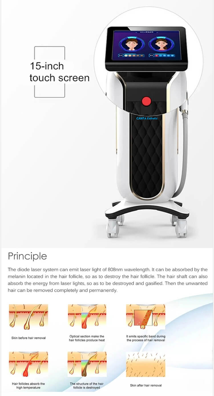 808 nm Diode Laser For Hair Removal LitePro 1