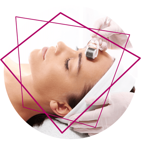 Micro-Needling