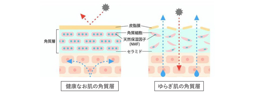 春はゆらぎ肌にご用心！