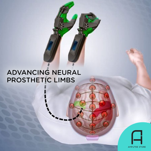 Advancing neural prosthetic limbs.